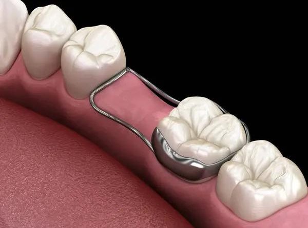 Cosmetic Dentistry Secrets to Enhance Your Confidence